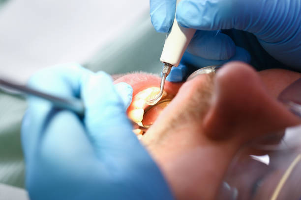 Best Emergency Tooth Extraction in Halifax, VA