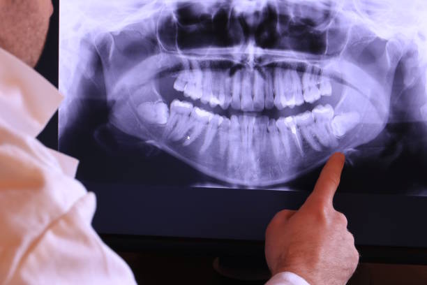 Best Emergency TMJ Treatment in Halifax, VA