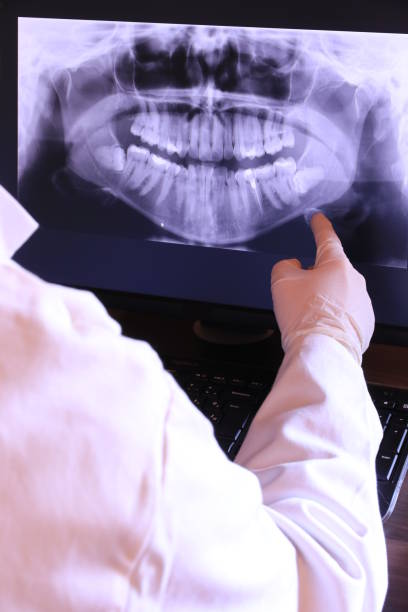 Best Emergency Wisdom Teeth Removal in Halifax, VA