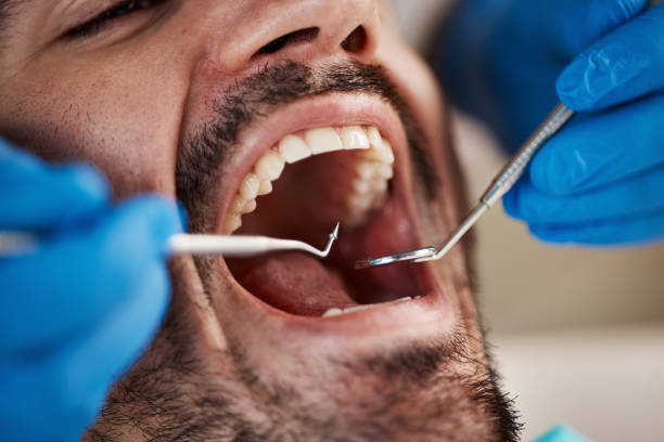Best Urgent Care for Lost Fillings or Crowns in Halifax, VA